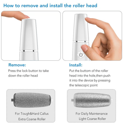 🥳2026 HOT SALE🥳💞50K+ SOLD!💥🎁✨ 50% OFF! Electric Feet Callus Remover – 360° roller, 3 speeds. Safe for dry & wet use. USB rechargeable, 100 mins runtime. Baby‑soft feet at home. 🦶💨