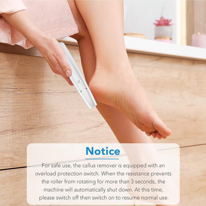 🥳2026 HOT SALE🥳💞50K+ SOLD!💥🎁✨ 50% OFF! Electric Feet Callus Remover – 360° roller, 3 speeds. Safe for dry & wet use. USB rechargeable, 100 mins runtime. Baby‑soft feet at home. 🦶💨