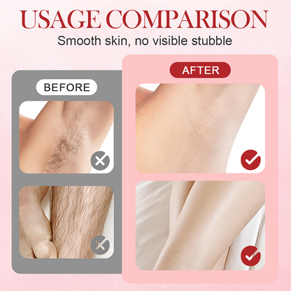 🔥Hot Sale Deals- Portable Dual-Head Electric Epilator