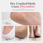 🦶 Electric Foot Callus Remover with Mist Spray