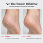 🦶 Electric Foot Callus Remover with Mist Spray